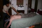 Acupuncture